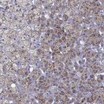 STAR Antibody in Immunohistochemistry (IHC)