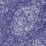 STAR Antibody in Immunohistochemistry (IHC)