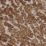 STAR Antibody in Immunohistochemistry (IHC)