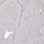 ESRP1 Antibody in Immunohistochemistry (Paraffin) (IHC (P))