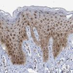 ESRP1 Antibody in Immunohistochemistry (Paraffin) (IHC (P))