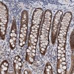 ESRP1 Antibody in Immunohistochemistry (IHC)