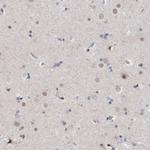 ESRP1 Antibody in Immunohistochemistry (IHC)