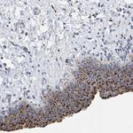 BIN3 Antibody in Immunohistochemistry (Paraffin) (IHC (P))