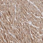 CHMP4C Antibody in Immunohistochemistry (Paraffin) (IHC (P))