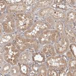 CHMP4C Antibody in Immunohistochemistry (Paraffin) (IHC (P))