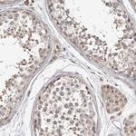 CHMP4C Antibody in Immunohistochemistry (IHC)