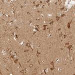 ARFGEF1 Antibody in Immunohistochemistry (Paraffin) (IHC (P))