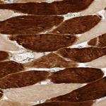 ARFGEF1 Antibody in Immunohistochemistry (Paraffin) (IHC (P))