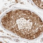 ARFGEF1 Antibody in Immunohistochemistry (Paraffin) (IHC (P))