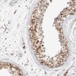 ZNF112 Antibody in Immunohistochemistry (IHC)