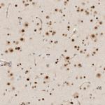 ZNF683 Antibody in Immunohistochemistry (Paraffin) (IHC (P))