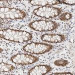 ZNF683 Antibody in Immunohistochemistry (Paraffin) (IHC (P))