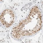 ZNF683 Antibody in Immunohistochemistry (Paraffin) (IHC (P))