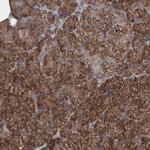 EPLIN Antibody in Immunohistochemistry (IHC)