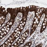 EPLIN Antibody in Immunohistochemistry (IHC)