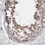 EPLIN Antibody in Immunohistochemistry (IHC)