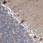 BAIAP2L1 Antibody in Immunohistochemistry (Paraffin) (IHC (P))