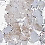 BAIAP2L1 Antibody in Immunohistochemistry (Paraffin) (IHC (P))