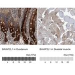 BAIAP2L1 Antibody in Immunohistochemistry (IHC)