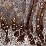 BAIAP2L1 Antibody in Immunohistochemistry (IHC)