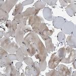 BAIAP2L1 Antibody in Immunohistochemistry (IHC)