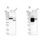 BAIAP2L1 Antibody in Western Blot (WB)