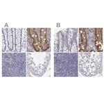 Adenosine Deaminase Antibody in Immunohistochemistry (IHC)