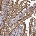 Adenosine Deaminase Antibody in Immunohistochemistry (IHC)