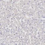 Adenosine Deaminase Antibody in Immunohistochemistry (IHC)