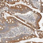 RAB11FIP1 Antibody in Immunohistochemistry (Paraffin) (IHC (P))