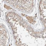 RAB11FIP1 Antibody in Immunohistochemistry (Paraffin) (IHC (P))