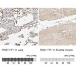 RAB11FIP1 Antibody in Immunohistochemistry (IHC)