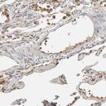 RAB11FIP1 Antibody in Immunohistochemistry (IHC)