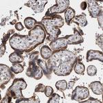 VCPIP1 Antibody in Immunohistochemistry (Paraffin) (IHC (P))