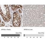 XPO5 Antibody in Immunohistochemistry (IHC)