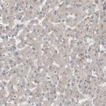 XPO5 Antibody in Immunohistochemistry (IHC)