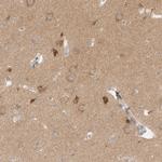 WIPF2 Antibody in Immunohistochemistry (IHC)