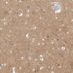 WIPF2 Antibody in Immunohistochemistry (IHC)