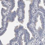 CEP131 Antibody in Immunohistochemistry (IHC)