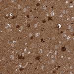 GBA2 Antibody in Immunohistochemistry (Paraffin) (IHC (P))