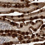 GBA2 Antibody in Immunohistochemistry (Paraffin) (IHC (P))