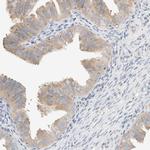 SUMF2 Antibody in Immunohistochemistry (IHC)