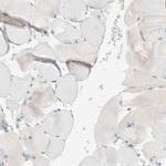 SUMF2 Antibody in Immunohistochemistry (IHC)