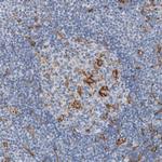 SKAP2 Antibody in Immunohistochemistry (Paraffin) (IHC (P))