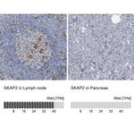 SKAP2 Antibody in Immunohistochemistry (IHC)