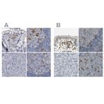 SKAP2 Antibody in Immunohistochemistry (IHC)