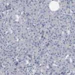 SKAP2 Antibody in Immunohistochemistry (IHC)