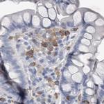 SKAP2 Antibody in Immunohistochemistry (IHC)