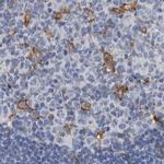 SKAP2 Antibody in Immunohistochemistry (IHC)